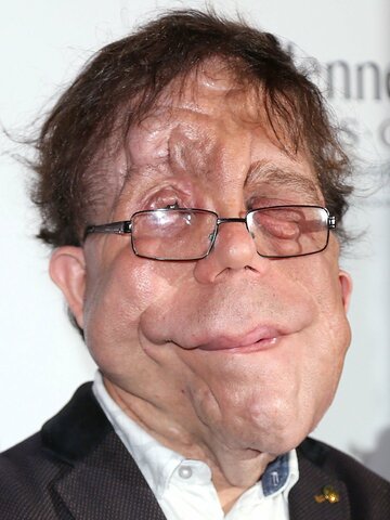 Adam Pearson Headshot