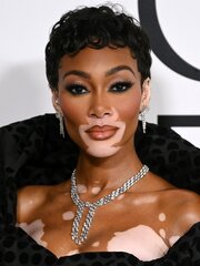 Winnie Harlow