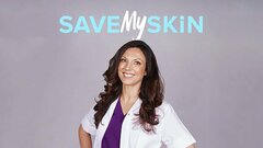 Save My Skin - TLC